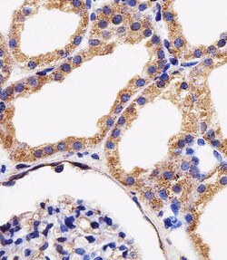 Adenylate Kinase 4 Polyclonal Antibody:Antibodies, Polyclonal