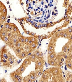 Adenylate Kinase 4 Polyclonal Antibody:Antibodies, Polyclonal