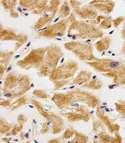 Adenylate Kinase 4 Polyclonal Antibody:Antibodies, Polyclonal