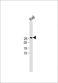 Adenylate Kinase 4 Polyclonal Antibody:Antibodies, Polyclonal