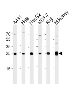 Adenylate Kinase 4 Polyclonal Antibody:Antibodies, Polyclonal