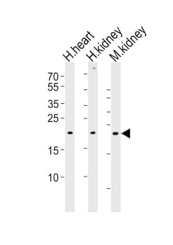 Invitrogen CYS1 Polyclonal Antibody 400 &mu;L; Unconjugated:Antibodies,