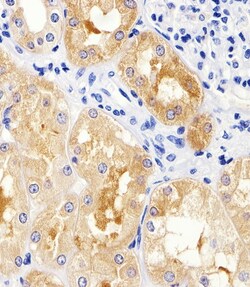 Invitrogen MAD2L2 Polyclonal Antibody 400 &mu;L | Buy Online | Invitrogen&trade; | Fisher Scientific