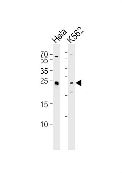Invitrogen MAD2L2 Polyclonal Antibody 400 &mu;L | Buy Online | Invitrogen&trade; | Fisher Scientific
