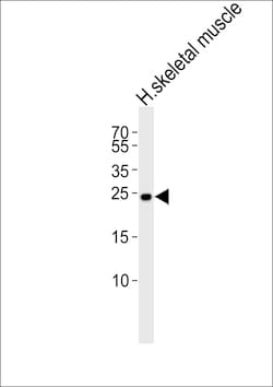 Invitrogen TMEM239 Polyclonal Antibody 400 &mu;L; Unconjugated:Antibodies,
