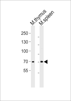 ITK Polyclonal Antibody:Antibodies, Polyclonal