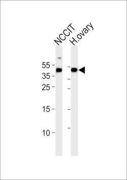 Invitrogen ESRG Polyclonal Antibody 400 &mu;L; Unconjugated:Antibodies,