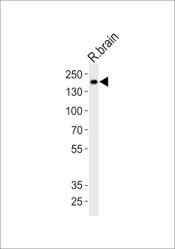 Invitrogen INSRR Polyclonal Antibody 400 &mu;L; Unconjugated:Anticuerpos