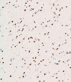 Invitrogen WDR82 Polyclonal Antibody 400 &mu;L; Unconjugated:Antibodies,