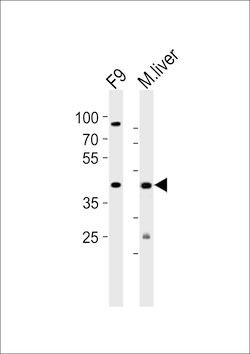 Ubtfl1 Polyclonal Antibody:Antibodies, Polyclonal