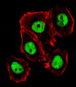 Invitrogen CTR9 Polyclonal Antibody 400 &mu;L; Unconjugated:Antibodies,