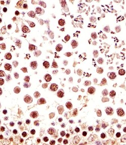 Invitrogen CTR9 Polyclonal Antibody 400 &mu;L; Unconjugated:Antibodies,