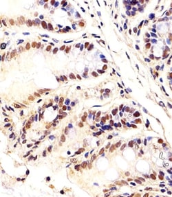 Invitrogen CTR9 Polyclonal Antibody 400 &mu;L; Unconjugated:Antibodies,