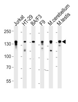 Invitrogen CTR9 Polyclonal Antibody 400 &mu;L; Unconjugated:Antibodies,