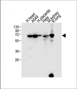 Invitrogen EHD2 Polyclonal Antibody 400 &mu;L; Unconjugated:Antibodies,