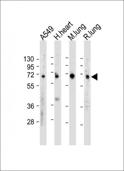Invitrogen EHD2 Polyclonal Antibody 400 &mu;L; Unconjugated:Antibodies,