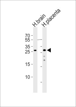 Invitrogen CHMP4A Polyclonal Antibody 400 &mu;L; Unconjugated:Antibodies,
