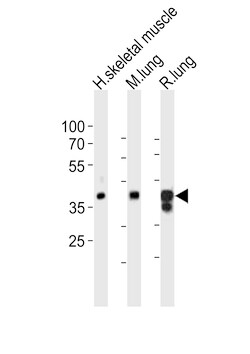 Invitrogen LMCD1 Polyclonal Antibody 400 &mu;L; Unconjugated:Antibodies,