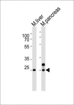 Invitrogen Noto Polyclonal Antibody 400 &mu;L; Unconjugated:Antibodies,
