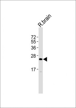Invitrogen UPK2 Polyclonal Antibody 400 &mu;L; Unconjugated:Antibodies,
