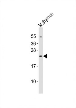 Invitrogen GINS1 Polyclonal Antibody 400 &mu;L; Unconjugated:Antibodies,