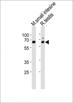 Invitrogen NR5A2 Polyclonal Antibody 400 &mu;L; Unconjugated:Antibodies,