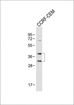 Invitrogen Nkx2.5 Polyclonal Antibody 200 &mu;L; Unconjugated:Antibodies,