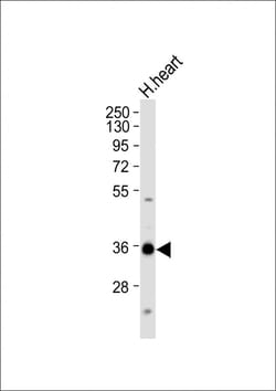 Invitrogen Nkx2.5 Polyclonal Antibody 200 &mu;L; Unconjugated:Antibodies,