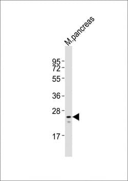 Invitrogen MESP1 Polyclonal Antibody 400 &mu;L; Unconjugated:Antibodies,
