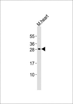Invitrogen MESP1 Polyclonal Antibody 400 &mu;L; Unconjugated:Antibodies,