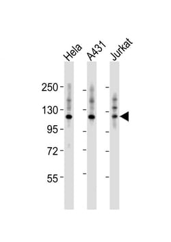 Invitrogen ITGA7 Polyclonal Antibody 400 &mu;L; Unconjugated:Antibodies,