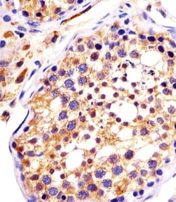 DYNC1H1 Polyclonal Antibody:Antibodies, Polyclonal