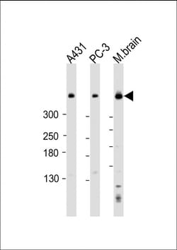 DYNC1H1 Polyclonal Antibody:Antibodies, Polyclonal
