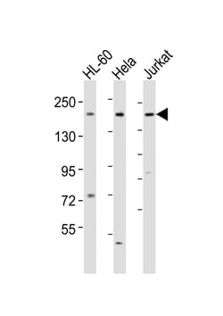Invitrogen DIP2A Polyclonal Antibody 80 &mu;L; Unconjugated:Antibodies,