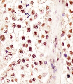 Invitrogen RBMX Polyclonal Antibody 400 &mu;L | Buy Online | Invitrogen&trade; | Fisher Scientific