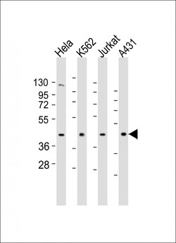 Invitrogen RBMX Polyclonal Antibody 400 &mu;L | Buy Online | Invitrogen&trade; | Fisher Scientific