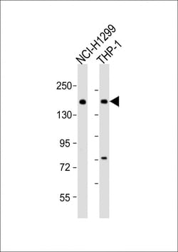 Invitrogen CaV2.1 Polyclonal Antibody 200 &mu;L; Unconjugated:Antibodies,