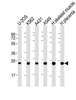 Invitrogen UQCRFS1P1 Polyclonal Antibody 200 &mu;L; Unconjugated:Antibodies,