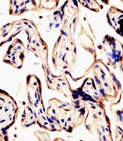 Invitrogen ERVK-7 Polyclonal Antibody 200 &mu;L; Unconjugated:Antibodies,
