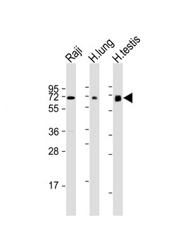 Invitrogen ERVK-7 Polyclonal Antibody 200 &mu;L; Unconjugated:Antibodies,