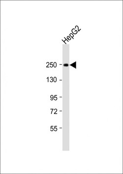Invitrogen MYO5B Polyclonal Antibody 200 &mu;L; Unconjugated:Antibodies,