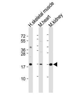 Invitrogen SDHC Polyclonal Antibody 200 &mu;L; Unconjugated:Anticuerpos