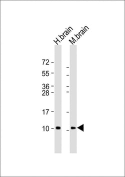 Invitrogen GNG2 Polyclonal Antibody 200 &mu;L; Unconjugated:Antibodies,