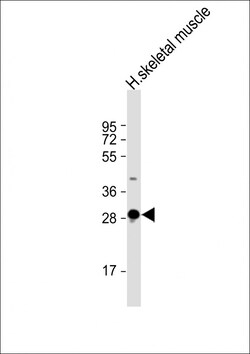 Invitrogen DNASE1L2 Polyclonal Antibody 200 &mu;L; Unconjugated:Antibodies,