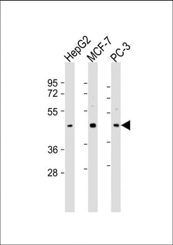 SAPCD2 Polyclonal Antibody:Antibodies, Polyclonal