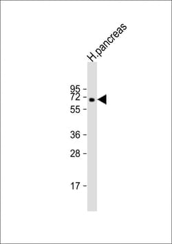 Invitrogen MGAT4B Polyclonal Antibody 200 &mu;L; Unconjugated:Antibodies,