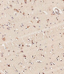 Invitrogen KMT2D Polyclonal Antibody 400 &mu;L; Unconjugated:Antibodies,