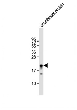 Invitrogen KMT2D Polyclonal Antibody 400 &mu;L; Unconjugated:Antibodies,