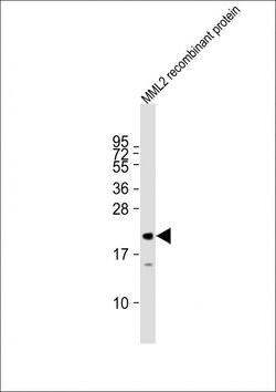 Invitrogen KMT2D Polyclonal Antibody 400 &mu;L; Unconjugated:Antibodies,