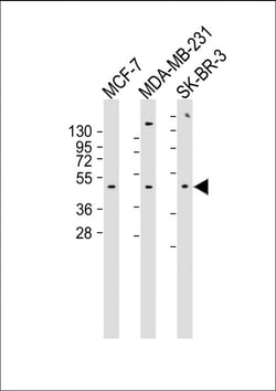 alpha-2b Adrenergic Receptor Polyclonal Antibody:Antibodies, Polyclonal